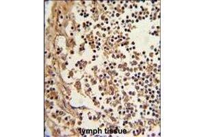 Immunohistochemistry (Paraffin-embedded Sections) (IHC (p)) image for anti-Eukaryotic Translation Elongation Factor 1 delta (Guanine Nucleotide Exchange Protein) (EEF1D) (AA 1-30), (N-Term) antibody (ABIN390423)