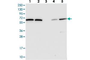 Western blot analysis of Lane 1: RT-4, Lane 2: U-251 MG, Lane 3: Human Plasma, Lane 4: Liver, Lane 5: Tonsil with POLR3E polyclonal antibody  at 1:250-1:500 dilution. (POLR3E 抗体)