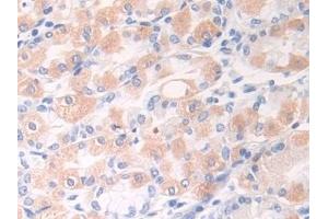 Immunohistochemistry (IHC) image for anti-Desmocollin 1 (DSC1) (AA 486-686) antibody (ABIN7436270)