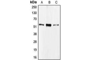 Western blot analysis of CDC20 expression in Raji (A), HEK293T (B), HL60 (C) whole cell lysates.