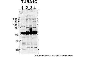 Sample Type: 1. (TUBA1C 抗体  (C-Term))