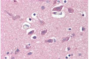 Human Brain, Cortex (formalin-fixed, paraffin-embedded) stained with GRIA2 antibody ABIN351533 at 1:50 followed by biotinylated anti-mouse IgG secondary antibody ABIN481714, alkaline phosphatase-streptavidin and chromogen. (GRIA2 抗体  (AA 175-430))