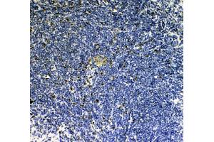 IHC analysis of IL33 using anti-IL33 antibody (ABIN5692884).