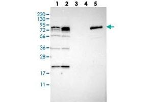 Western blot analysis of Lane 1: RT-4, Lane 2: U-251 MG, Lane 3: Human Plasma, Lane 4: Liver, Lane 5: Tonsil with PNPLA8 polyclonal antibody  at 1:250-1:500 dilution. (PNPLA8 抗体)