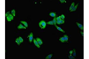 Immunofluorescent analysis of HepG2 cells using ABIN7159887 at dilution of 1:100 and Alexa Fluor 488-congugated AffiniPure Goat Anti-Rabbit IgG(H+L) (TIMM1B (AA 1-103) 抗体)