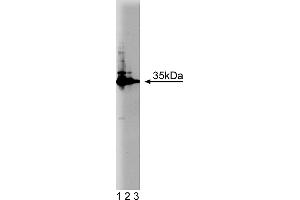 Western Blotting (WB) image for anti-HCLS1 Associated Protein X-1 (HAX1) (AA 10-148) antibody (ABIN968199) (HAX1 抗体  (AA 10-148))