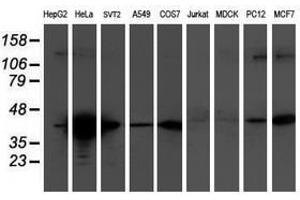 Image no. 2 for anti-Tropomodulin 1 (TMOD1) antibody (ABIN1501528) (Tropomodulin 1 抗体)
