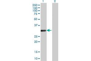 Western Blotting (WB) image for anti-Voltage-Dependent Anion Channel 2 (VDAC2) (AA 1-294) antibody (ABIN521316)
