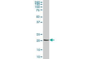 Western Blotting (WB) image for anti-Proteasome (Prosome, Macropain) Subunit, beta Type, 8 (Large Multifunctional Peptidase 7) (PSMB8) (AA 1-272) antibody (ABIN519381)