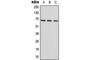 Western blot analysis of HIC2 expression in HepG2 (A), HeLa (B), NIH3T3 (C) whole cell lysates. (HIC2 抗体  (Center))