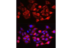 Immunofluorescence analysis of HeLa cells using Cytokeratin 17 (KRT17) Rabbit pAb (ABIN6130112, ABIN6143023, ABIN6143024 and ABIN6213626) at dilution of 1:200 (40x lens). (KRT17 抗体  (AA 133-432))
