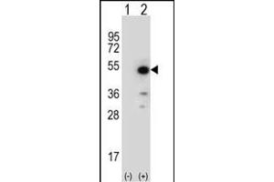 Western blot analysis of ID (arrow) using rabbit polyclonal ID Antibody (N-term) (ABIN652735 and ABIN2842487). (PPID 抗体  (N-Term))