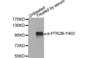 Western blot analysis of extracts from 293 cells, using Phospho-PTK2B-Y402 antibody.