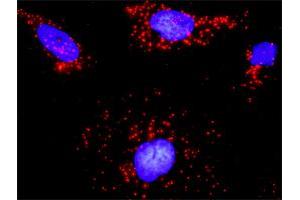 Proximity Ligation Analysis of protein-protein interactions between CDC42 and ARHGEF6. (ARHGEF6 抗体  (AA 61-175))