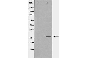 Western blot analysis of Mouse kidney lysate, using PRNP Antibody. (PRNP 抗体  (Internal Region))