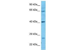 Western Blotting (WB) image for anti-Prostate Tumor Overexpressed 1 (PTOV1) (N-Term) antibody (ABIN2784251)
