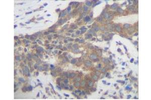 Image no. 2 for anti-Placenta Growth Factor (PGF) antibody (ABIN181639) (PLGF 抗体)