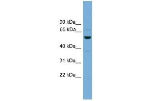 ASZ1 antibody used at 1 ug/ml to detect target protein. (ASZ1 抗体  (Middle Region))