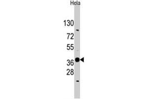 Western blot analysis of EDA polyclonal antibody  in HeLa cell lysate (35 ug/lane). (Ectodysplasin A 抗体  (N-Term))