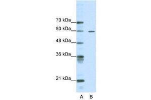 WB Suggested Anti-ARID3A  Antibody Titration: 0. (ARID3A 抗体  (Middle Region))