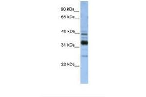 Image no. 1 for anti-Thioredoxin-Related Transmembrane Protein 4 (TMX4) (C-Term) antibody (ABIN6738588)