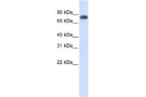 MST1 antibody used at 1 ug/ml to detect target protein. (MST1 抗体)
