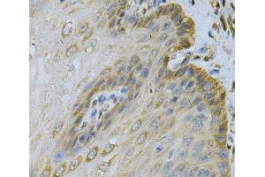 Immunohistochemistry of paraffin-embedded Human esophagus using PGK1 Polyclonal Antibody at dilution of 1:100 (40x lens). (PGK1 抗体)