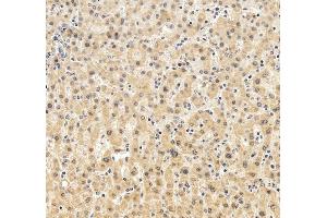 anti-Glutamate-Ammonia Ligase (GLUL) (AA 74-373) antibody