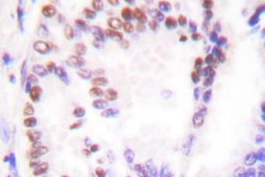 Image no. 1 for anti-Histone Deacetylase 9 (HDAC9) antibody (ABIN265461) (HDAC9 抗体)