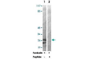 Western blot analysis of extracts from 293 cells treated with Forskolin (40 nM, 30 min) using YWHAZ polyclonal antibody . (14-3-3 zeta 抗体)