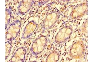 Immunohistochemistry of paraffin-embedded human colon tissue using ABIN7151974 at dilution of 1:100 (EDEM2 抗体  (AA 22-300))