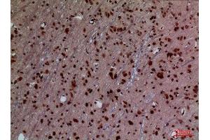 Immunohistochemistry (IHC) analysis of paraffin-embedded Rat Brain, antibody was diluted at 1:100. (HOXD3 抗体  (Internal Region))
