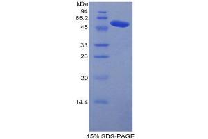 SDS-PAGE (SDS) image for Carboxypeptidase N Subunit 1 (CPN1) (AA 221-449) protein (His tag,GST tag) (ABIN2122550)