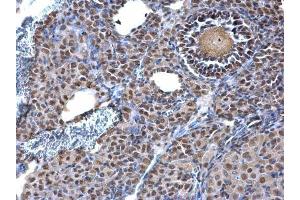 IHC-P Image KAP1 antibody [N1N2], N-term detects KAP1 protein at nucleus on mouse ovary by immunohistochemical analysis.