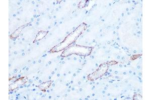 Immunohistochemistry of paraffin-embedded rat kidney using IR Rabbit mAb (ABIN7268009) at dilution of 1:100 (40x lens). (IRAK2 抗体)