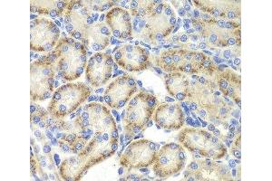 Immunohistochemistry of paraffin-embedded Rat kidney using ST3GAL4 Polyclonal Antibody at dilution of 1:200 (40x lens). (ST3GAL4 抗体)