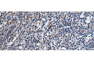 Immunohistochemistry of paraffin-embedded Human tonsil tissue using TNFSF18 Polyclonal Antibody at dilution of 1:45(x200) (TNFSF18 抗体)