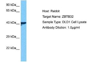 Host: Rabbit Target Name: ZBTB32 Sample Tissue: Human DLD1 Whole Cell Antibody Dilution: 1ug/ml (ZBTB32 抗体  (N-Term))