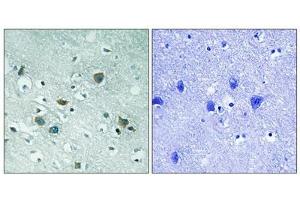 Immunohistochemical analysis of paraffin-embedded human brain tissue using CRMP-2 (Phospho-Thr509) antibody (left)or the same antibody preincubated with blocking peptide (right). (DPYSL2 抗体  (pThr509))