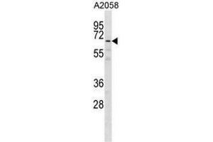 GPKOW Antibody (Center) western blot analysis in A2058 cell line lysates (35µg/lane). (GPKOW 抗体  (Middle Region))