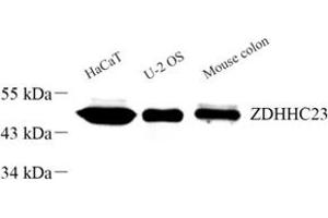 Western blot analysis of ZDHHC23 (ABIN7076281) at dilution of 1: 300 (ZDHHC23 抗体)