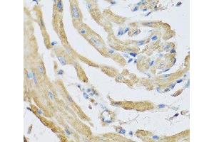 Immunohistochemistry of paraffin-embedded Mouse heart using SFRP4 Polyclonal Antibody at dilution of 1:100 (40x lens). (SFRP4 抗体)
