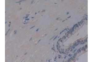 Immunohistochemistry (IHC) image for anti-Protein Kinase, AMP-Activated, alpha 1 Catalytic Subunit (PRKAA1) (AA 28-257) antibody (ABIN7440413)