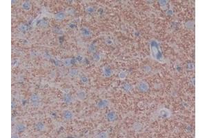 Immunohistochemistry (IHC) image for anti-Angiotensin I Converting Enzyme 2 (ACE2) (AA 392-739) antibody (ABIN7434278)