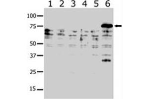 Western blot analysis of PAK6 polyclonal antibody  in lysates from transiently transfected COS-7 cells. (PAK6 抗体  (AA 131-146))
