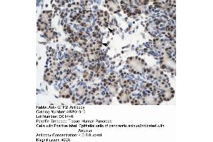 Rabbit Anti-GTF21 Antibody  Paraffin Embedded Tissue: Human Pancreas Cellular Data: Epithelial cells of pancreatic acinus Antibody Concentration: 4. (GTF2I 抗体  (N-Term))