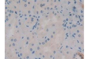 Immunohistochemistry (IHC) image for anti-Calbindin 2 (CALB2) (AA 28-248) antibody (ABIN7432391)