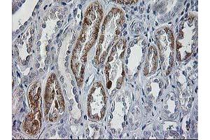 Immunohistochemistry (IHC) image for anti-Cerebral Cavernous Malformation 2 (CCM2) antibody (ABIN1497131) (CCM2 抗体)