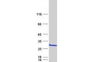 Validation with Western Blot (CDC42 Protein (Transcript Variant 3) (Myc-DYKDDDDK Tag))