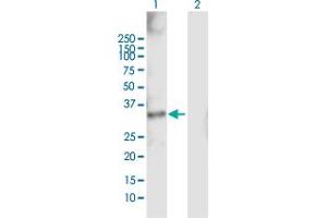 Western Blot analysis of RDHE2 expression in transfected 293T cell line by RDHE2 MaxPab polyclonal antibody. (SDR16C5 抗体  (AA 1-309))